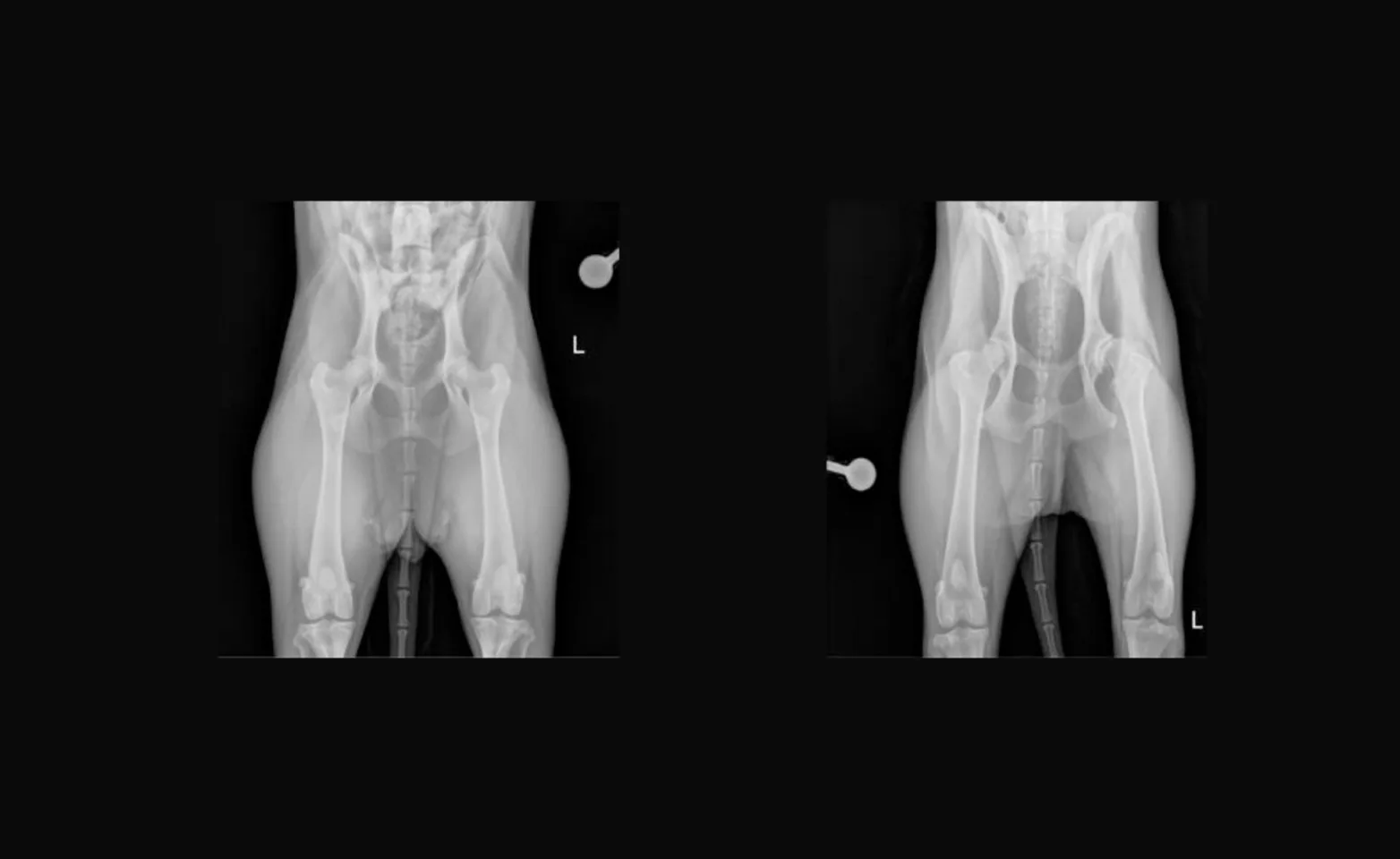 Xrays for Total Hip Replacement
